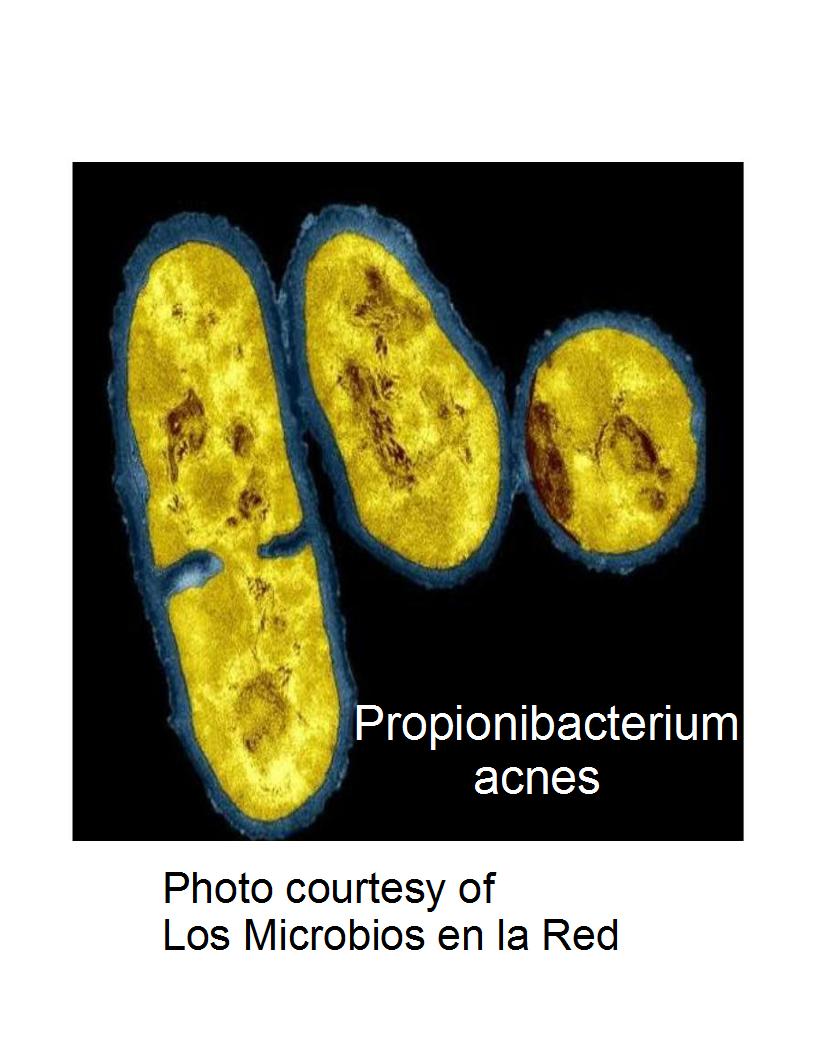 Where Are You Keeping Your Propionibacterium Cultures?