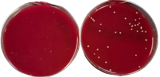 Two Brucella blood agar plates inoculated with Porphyromonas levii. The plate on the left shows sparse colonies; the plate on the right shows dense colony growth.